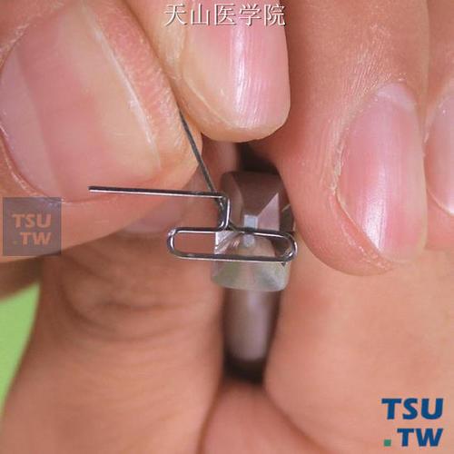 正畸t型曲弯制-图1