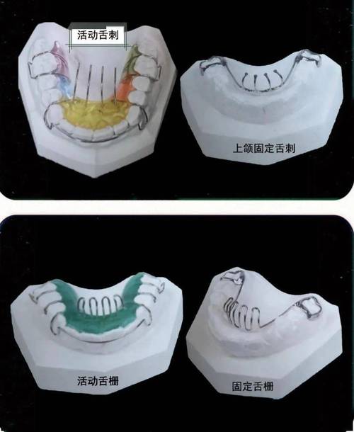 正畸矫治器发展-图2