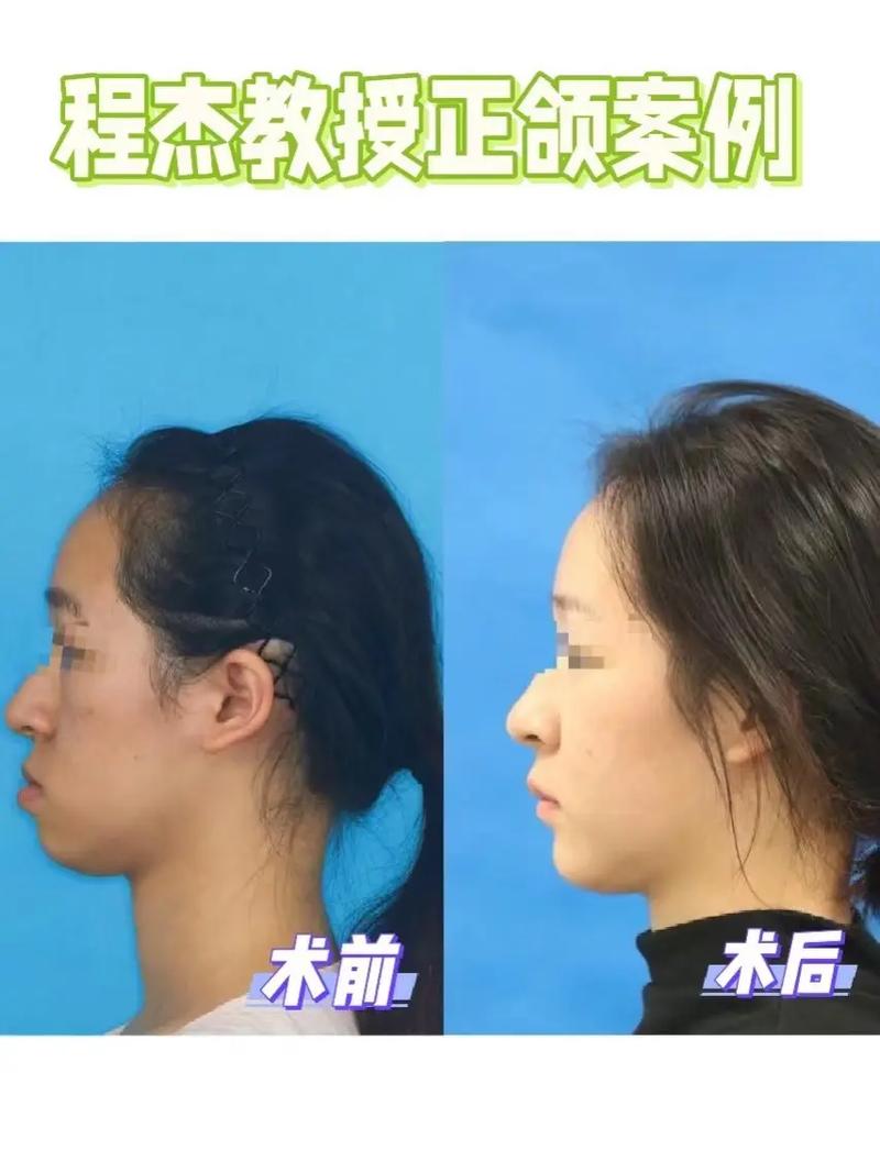 正畸后脸变歪了-图2