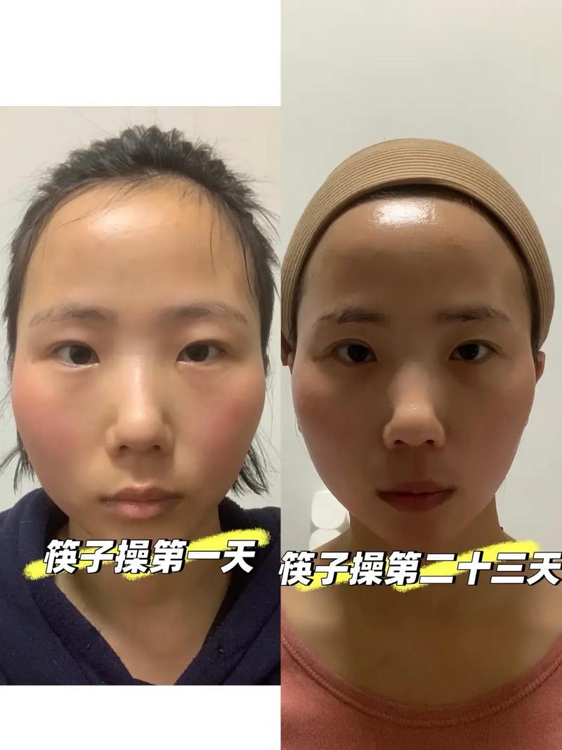 正畸后脸变歪了-图3