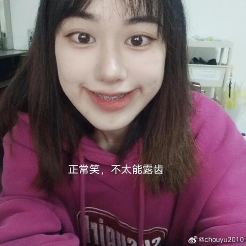 正畸牙弓变窄了-图1