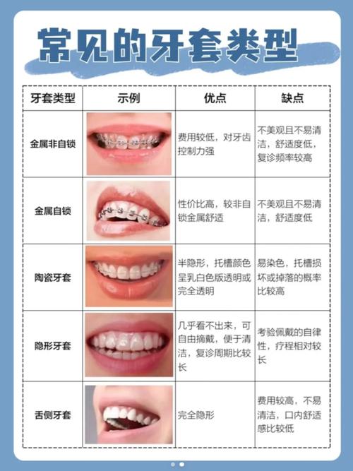 正畸牙套种类多，金属、隐形、陶瓷等具体区别在哪？-图2