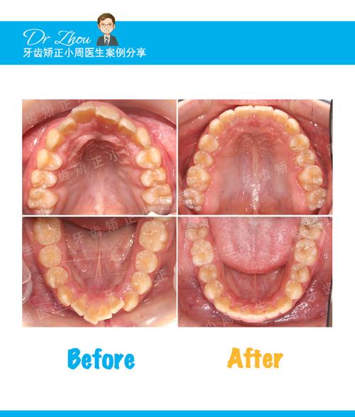 北大口腔正畸脸-图2