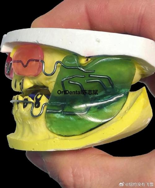 安氏III类错颌正畸矫正的关键难点是什么？-图3