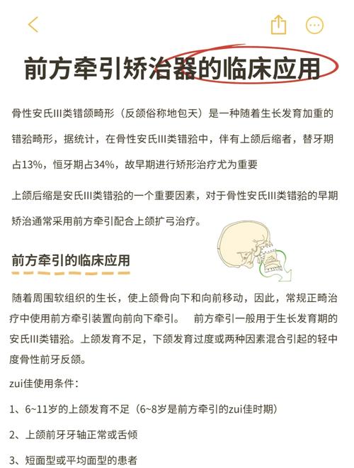 正畸J钩的戴法-图2