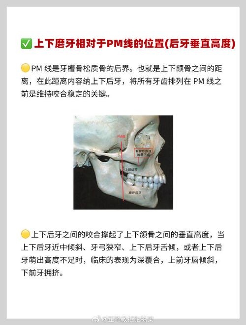 正畸骨面性课件-图3