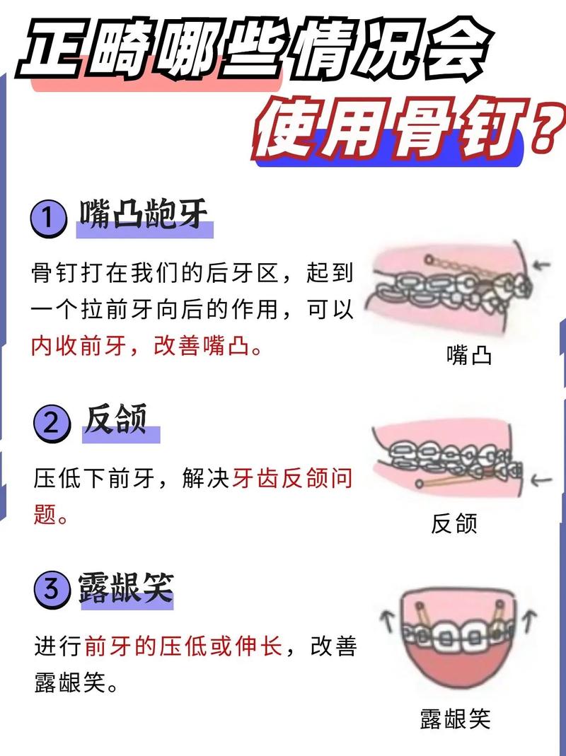 正畸骨型分类有哪些常见类型及标准？-图3