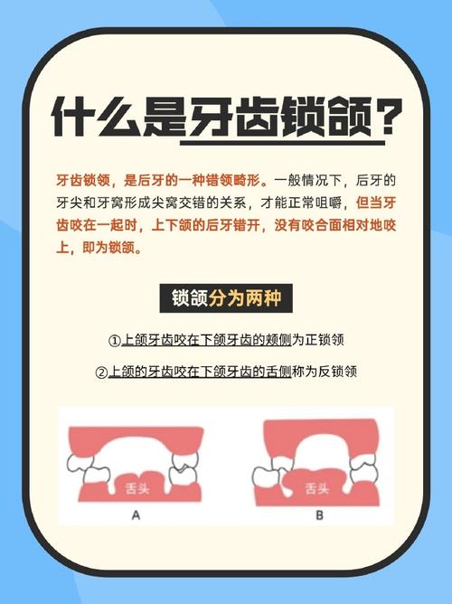 锁颌不能正畸吗-图1