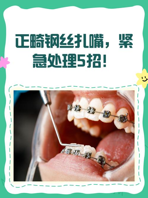 正畸单扎是什么?单颗牙齿矫正的新选择?-图1 正畸单扎是什么?单颗牙齿矫正的新选择?-图1