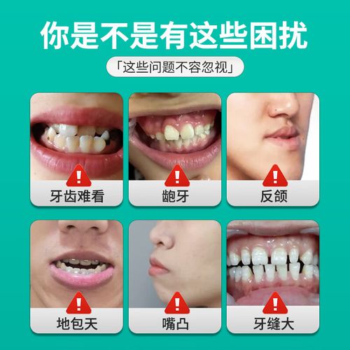 正畸门牙粘了垫-图1