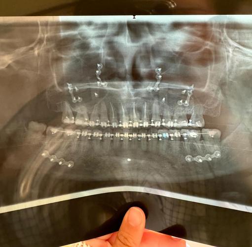 正畸颌面照视频-图2