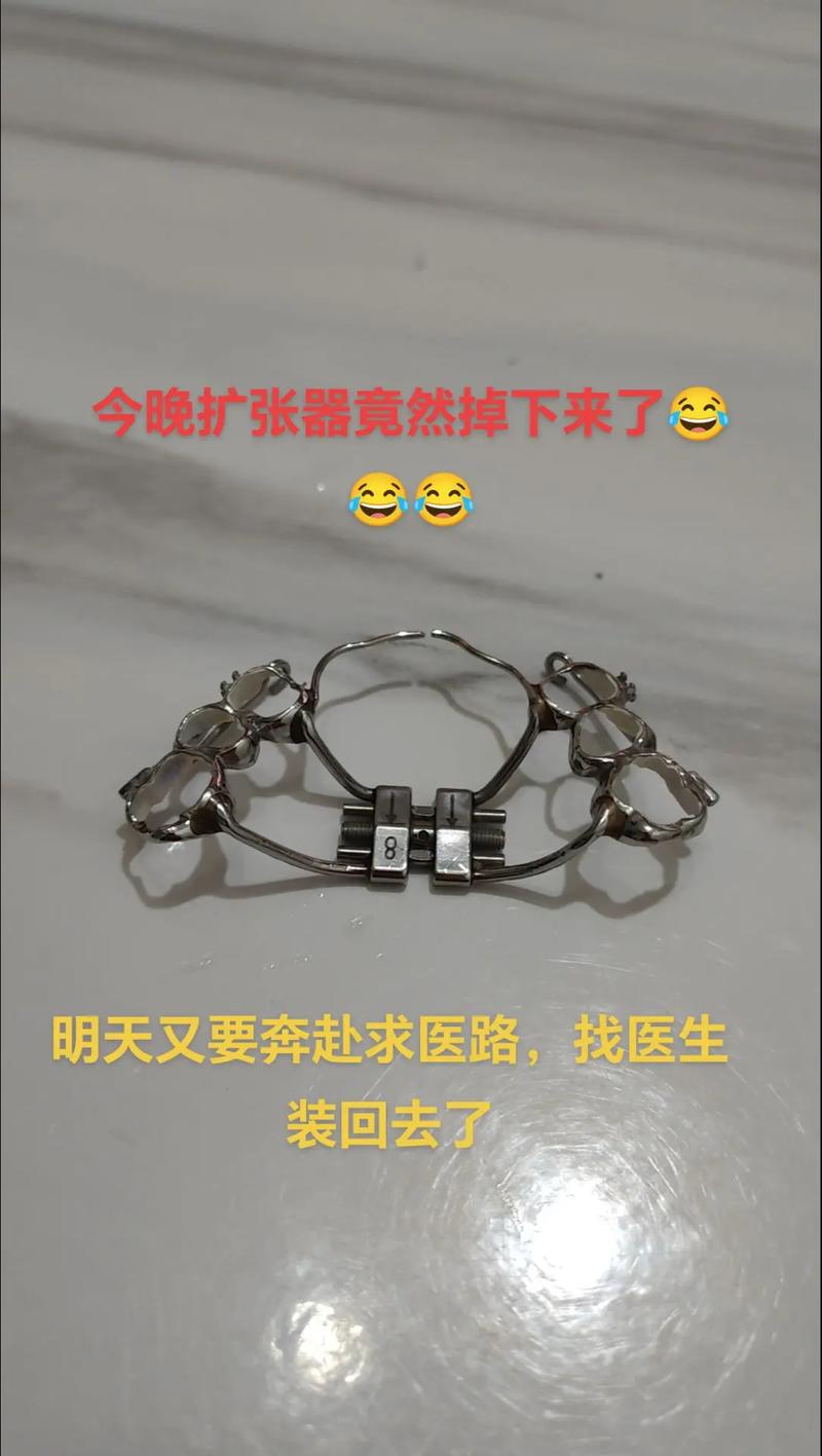 许天民正畸发明-图1 许天民正畸发明-图1