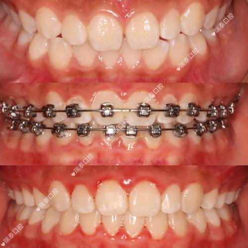 相城牙博士正畸-图2 相城牙博士正畸-图2