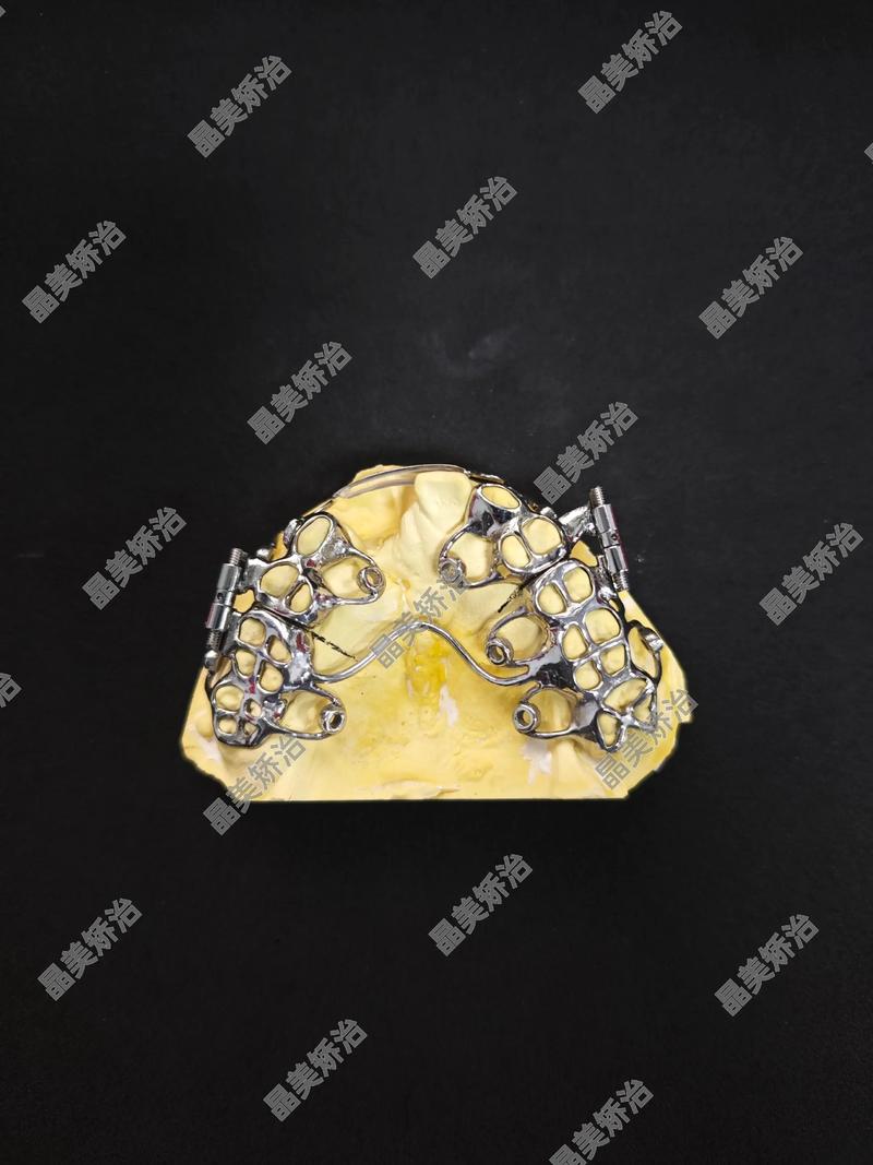 数字化正畸设计-图1 数字化正畸设计-图1