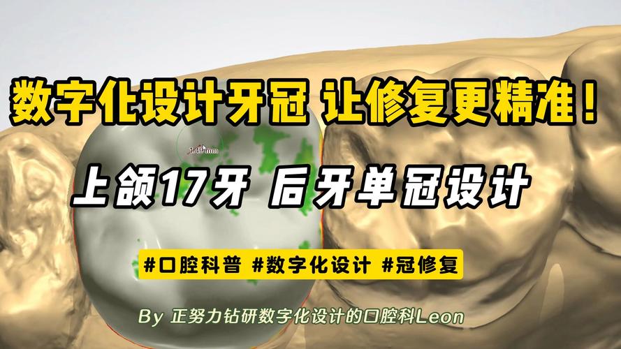数字化正畸设计-图3 数字化正畸设计-图3