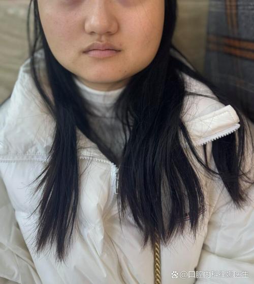 正畸后嘴巴歪了？矫正失败还是正常反应？-图1