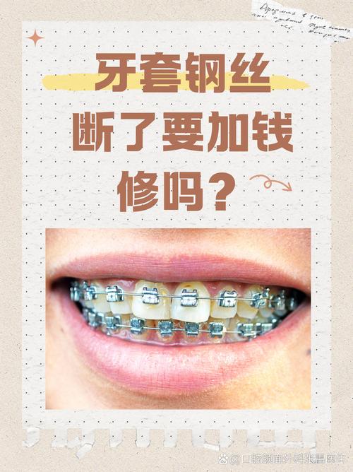 正畸费用高，没钱该如何是好？-图2