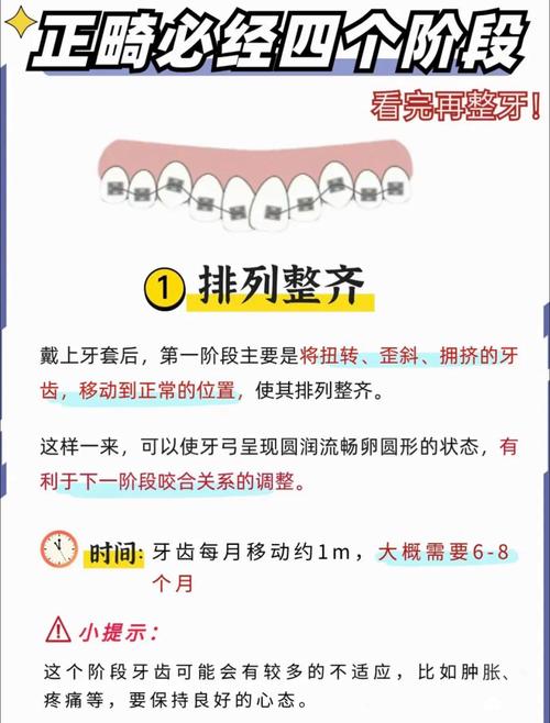 正畸颌垫的原理-图1