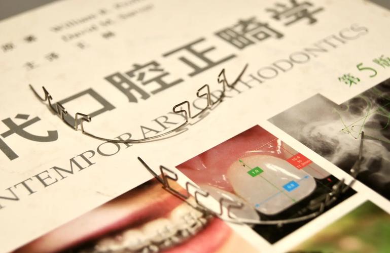 正畸最先进技术-图3