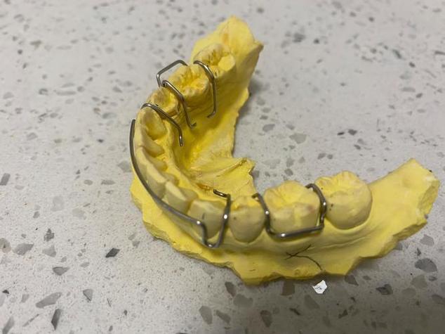 正畸端部钢丝刮伤口腔，原因何在？如何有效处理？-图2