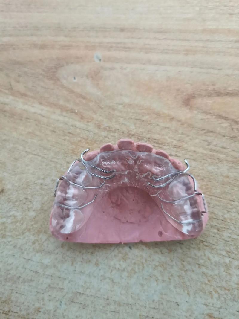 正畸口内阻挡臂-图1