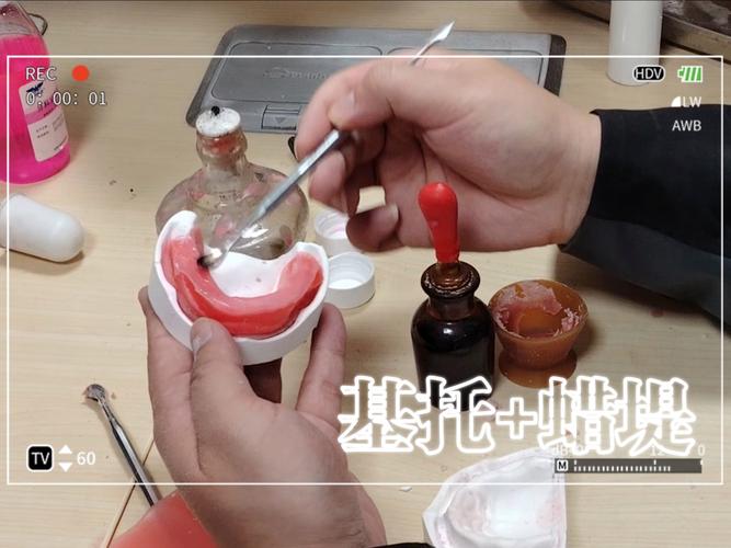 正畸蜡怎样取下-图2