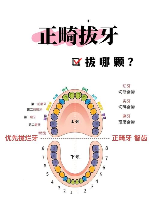 拔牙正畸危险么-图2 拔牙正畸危险么-图2