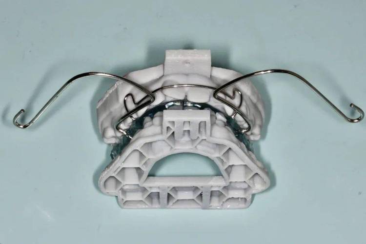 正畸矫治系统有哪些？如何判断哪种更适合自己？-图3