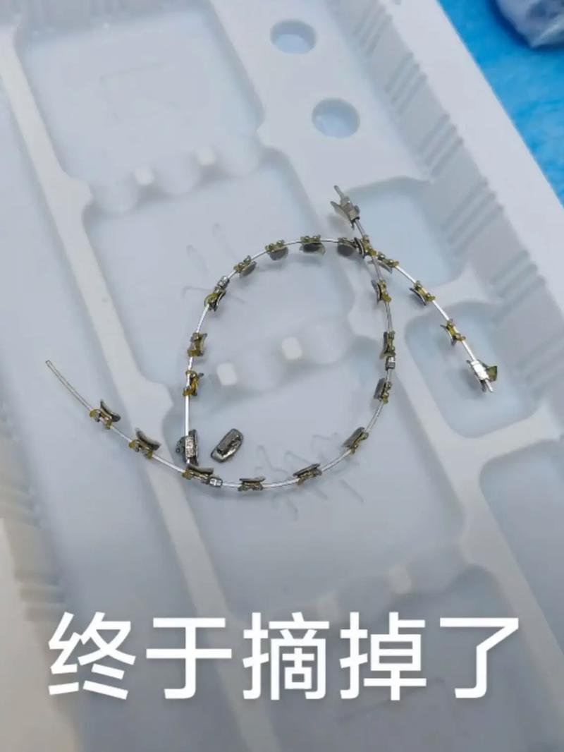 杭州正畸讨论群-图1 杭州正畸讨论群-图1