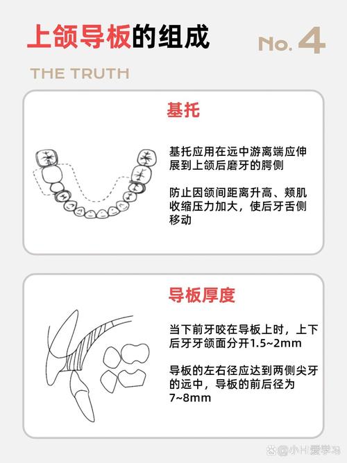 正畸导板的作用-图1