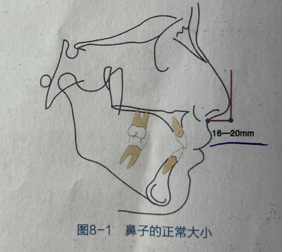 正畸z角 范围-图2 正畸z角 范围-图2