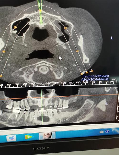 正畸用北医分析具体指什么?有何独特优势?-图1 正畸用北医分析具体指什么?有何独特优势?-图1