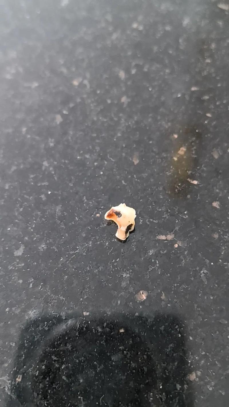 正畸中门牙脱落-图1 正畸中门牙脱落-图1