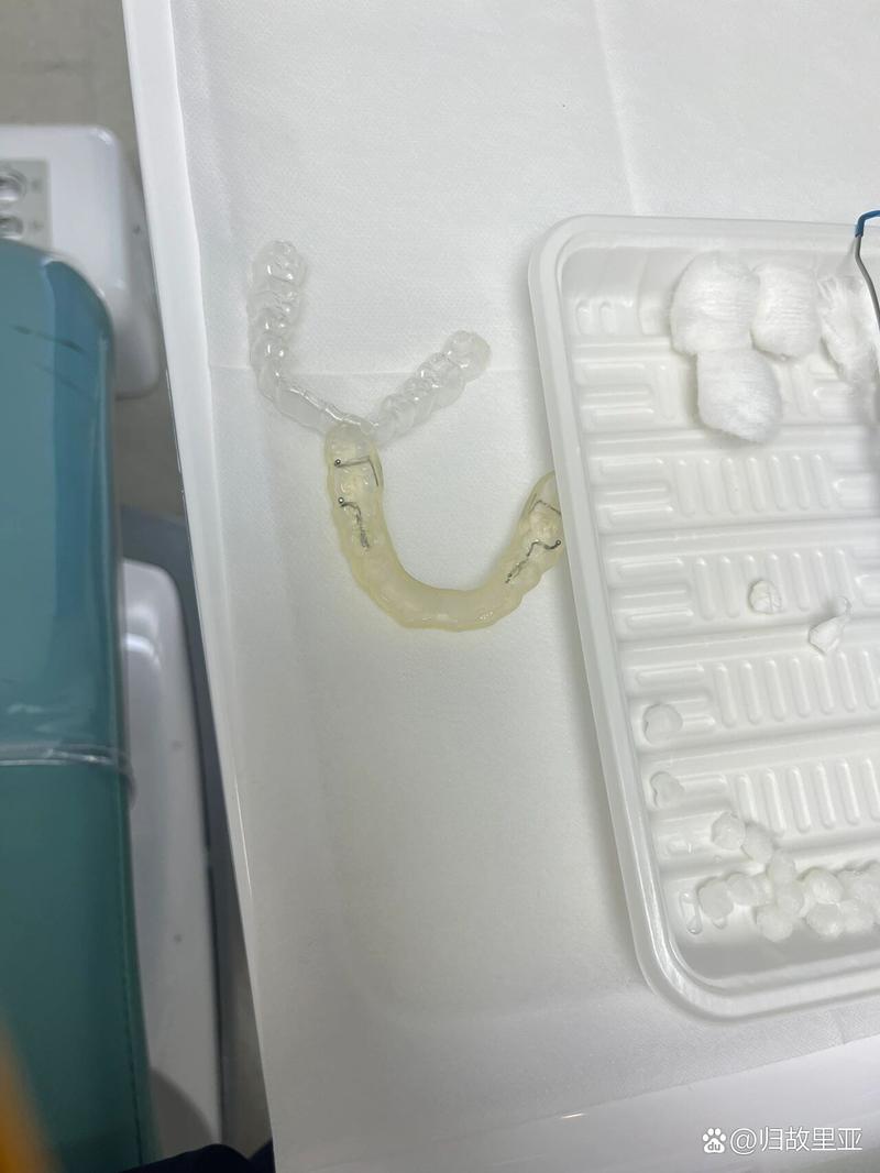 正畸 钢丝越粗-图2 正畸 钢丝越粗-图2