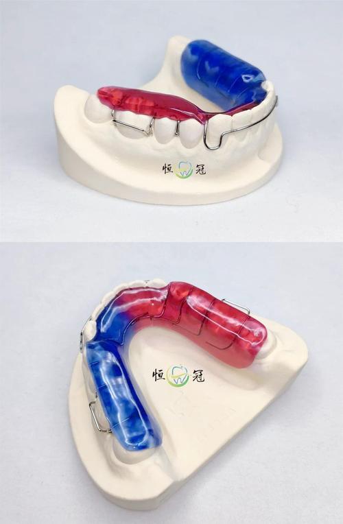 牙齿矫正导板有什么用-图2