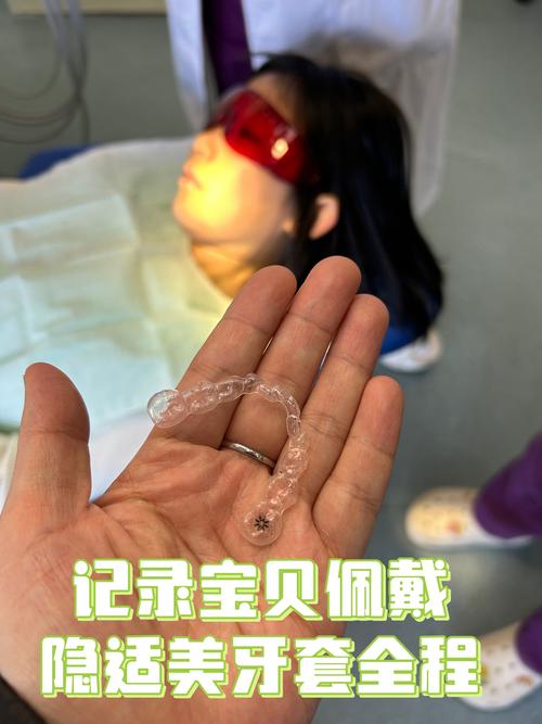 隐适美矫正牙齿的步骤是怎样的？详细流程和注意事项有哪些？-图3