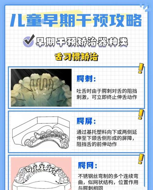 宝宝多大适合开始牙齿矫正？-图3