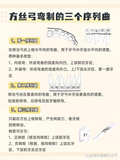 弓丝矫正牙齿的原理是什么？弓丝如何通过力学作用改变牙齿位置？-图2