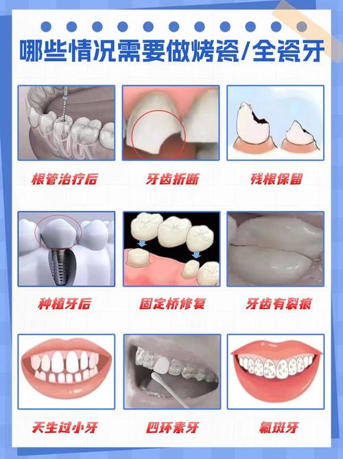 牙齿矫正好还是烤瓷牙-图1
