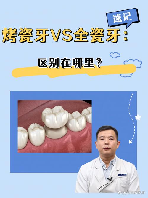 牙齿矫正好还是烤瓷牙-图2