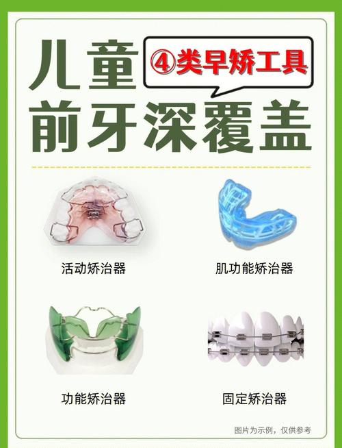 儿童牙齿矫正器有哪些-图2