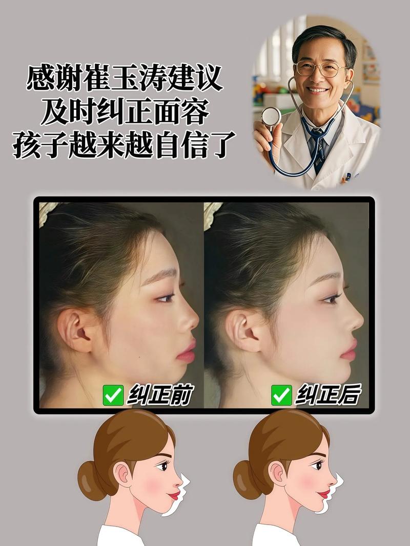 牙齿矫正会影响下巴形态吗？-图2