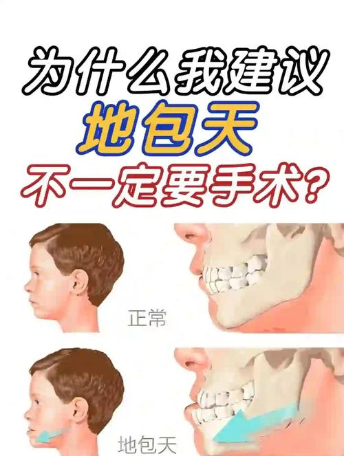 牙齿天包地一定要矫正吗？不矫正会有哪些影响？-图1