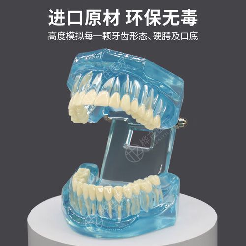 矫正牙齿为什么要做牙模？关键作用究竟是什么？-图2