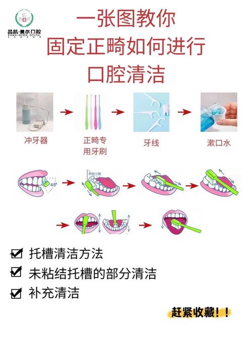 矫正期间如何清洁牙齿-图1