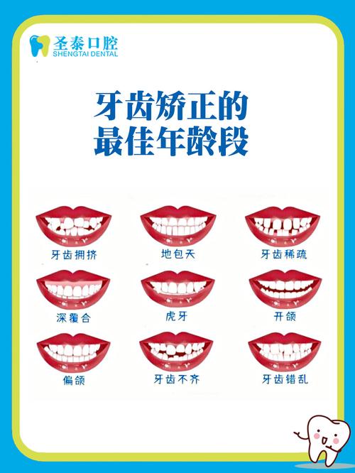 牙齿矫正的最佳年龄是多少？几岁做最合适？-图2