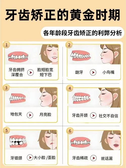 牙齿矫正牙箍总掉原因-图1