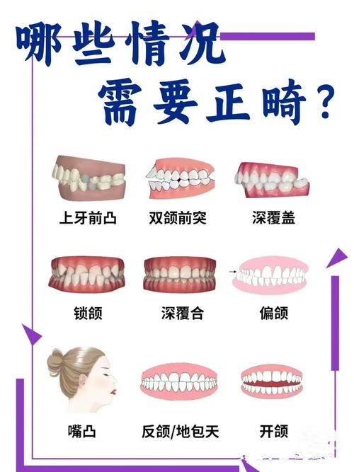 牙齿哪些样子出现就需要矫正？-图1