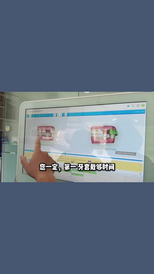 牙齿矫正复诊要交钱吗-图3