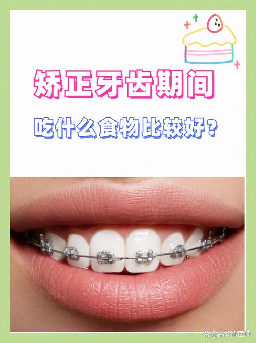 矫正牙齿期间，哪些食物能吃？哪些不能吃？饮食选择有讲究？-图3